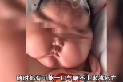 ​“用抑菌霜变大头娃”女婴父亲含糊炒作:借视频指示网友