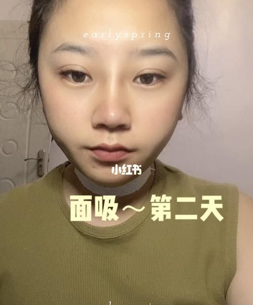 一个面冲配几个面吸