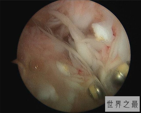 关于人体骨骼的十大事实，人体骨骼的这些奥秘你都知道吗？