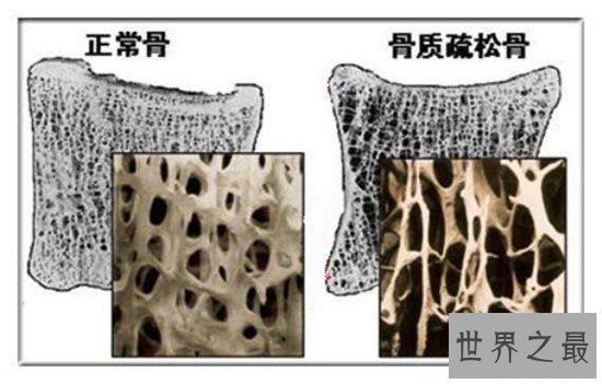 关于人体骨骼的十大事实，人体骨骼的这些奥秘你都知道吗？