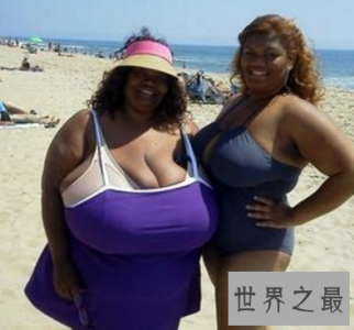 ​世界上最大的胸 双乳重达77斤真的有人喜欢吗