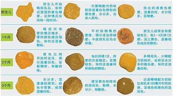 宝宝正常的便便到底应该长啥样?！